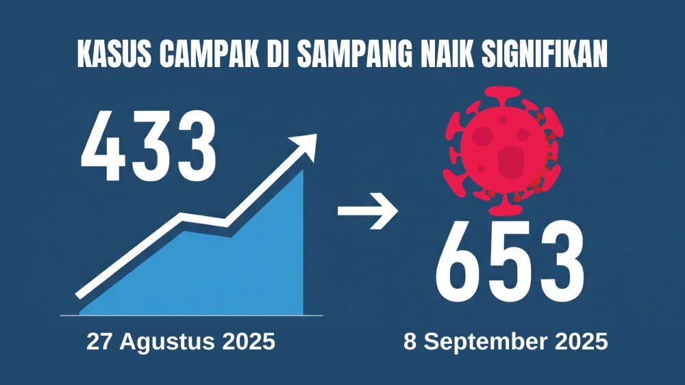 Campak